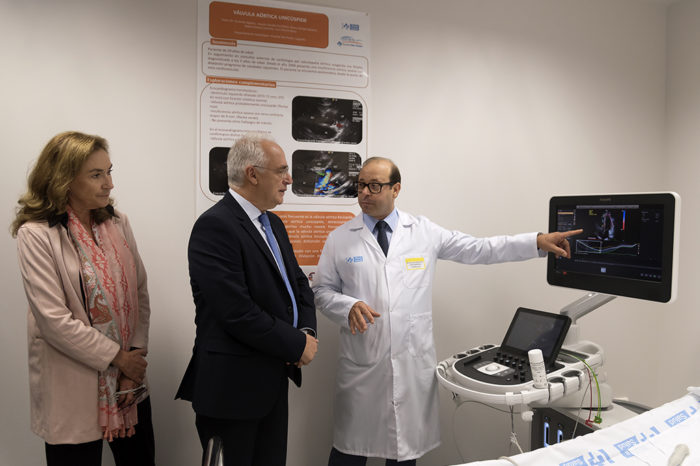 El San Pedro ofrece un diagnóstico cardiológico más preciso y menos invasivo